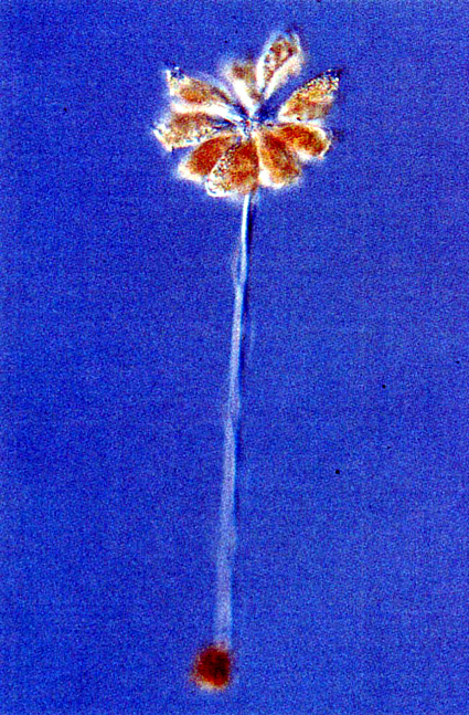 新属、新種のツリガネムシ