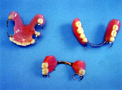 県難病連絡協が“入れ歯リサイクル”